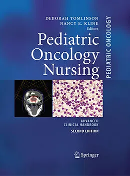 E-Book (pdf) Pediatric Oncology Nursing von Nancy E. Kline, Deborah Tomlinson