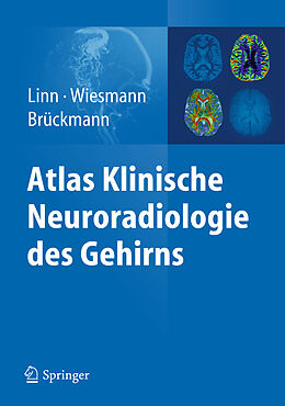 Fester Einband Atlas Klinische Neuroradiologie des Gehirns von Linn, Wiesmann, Brückmann