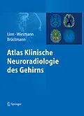 E-Book (pdf) Atlas Klinische Neuroradiologie des Gehirns von Jennifer Linn, Martin Wiesmann, Hartmut Brückmann