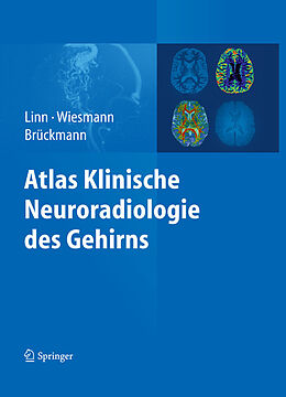 E-Book (pdf) Atlas Klinische Neuroradiologie des Gehirns von Jennifer Linn, Martin Wiesmann, Hartmut Brückmann