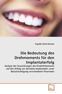 Kartonierter Einband Die Bedeutung des Drehmoments für den Implantaterfolg von Angelika Ehlich-Beutter