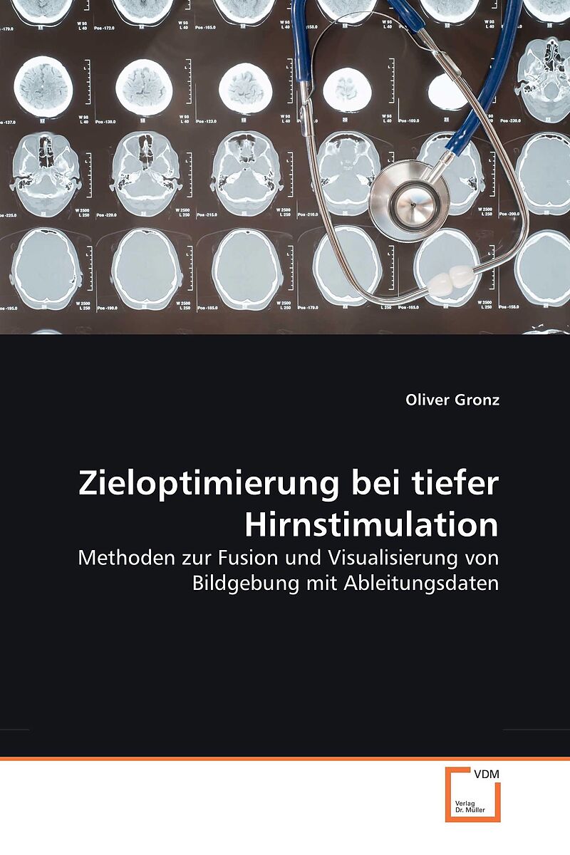 Zieloptimierung bei tiefer Hirnstimulation
