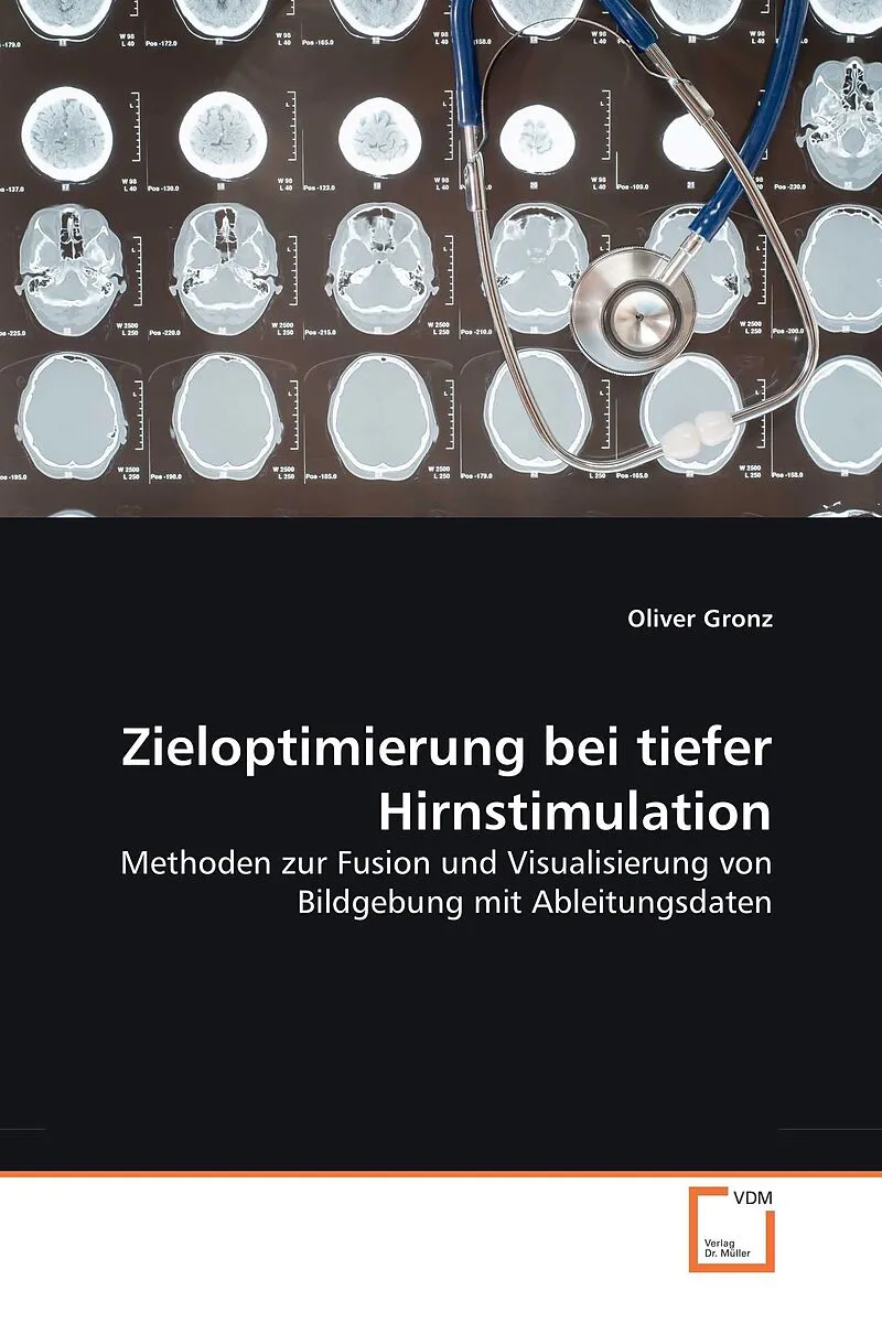 Zieloptimierung bei tiefer Hirnstimulation