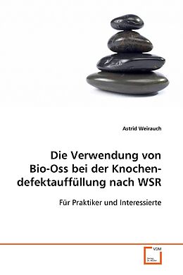 Kartonierter Einband Die Verwendung von Bio-Oss bei der Knochendefektauffüllung nach WSR von Astrid Weirauch