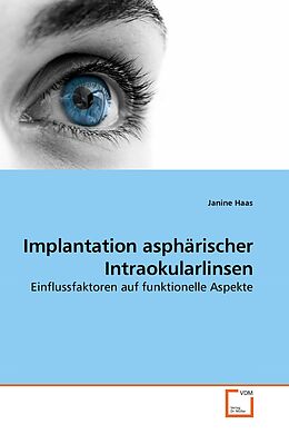 Kartonierter Einband Implantation asphärischer Intraokularlinsen von Janine Haas