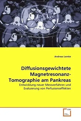 Diffusionsgewichtete Magnetresonanz-Tomographie am Pankreas