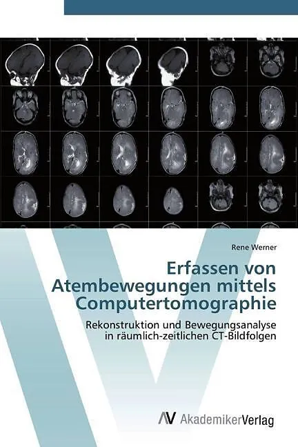 Erfassen von Atembewegungen mittels Computertomographie