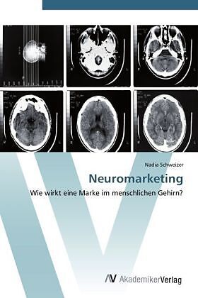 Neuromarketing