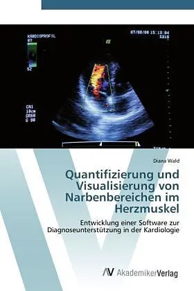 Quantifizierung und Visualisierung von Narbenbereichen im Herzmuskel