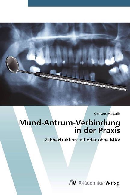 Mund-Antrum-Verbindung in der Praxis