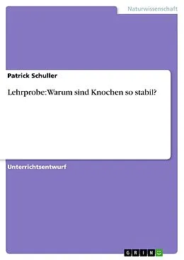 E-Book (pdf) Lehrprobe: Warum sind Knochen so stabil? von Patrick Schuller