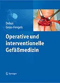 E-Book (pdf) Operative und interventionelle Gefäßmedizin von Eike Sebastian Debus, Walter Gross-Fengels
