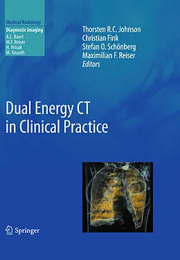 E-Book (pdf) Dual Energy CT in Clinical Practice von Thorsten Johnson, Christian Fink, Stefan O. Schoenberg
