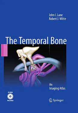 E-Book (pdf) Temporal Bone von John I. Lane, Robert J. Witte