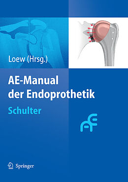 E-Book (pdf) AE-Manual der Endoprothetik von Markus Loew
