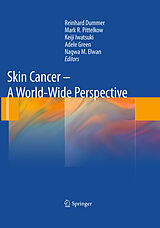 eBook (pdf) Skin Cancer - A World-Wide Perspective de Nagwa M. Elwan, Adèle Green, Keiji Iwatsuki