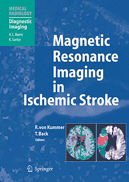 Couverture cartonnée Magnetic Resonance Imaging in Ischemic Stroke de 