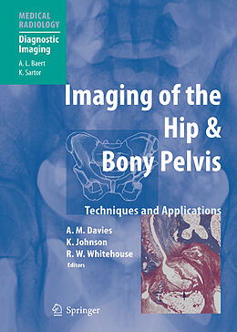 Couverture cartonnée Imaging of the Hip & Bony Pelvis de 