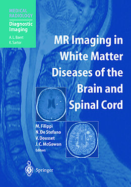 Couverture cartonnée MR Imaging in White Matter Diseases of the Brain and Spinal Cord de 