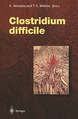 Kartonierter Einband Clostridium difficile von 