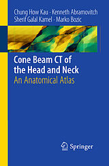 eBook (pdf) Cone Beam CT of the Head and Neck de Chung H. Kau, Kenneth Abramovitch, Sherif Galal Kamel