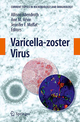 Livre Relié Varicella-zoster Virus de 