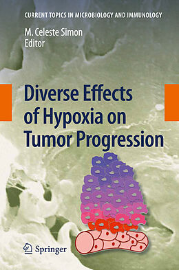 Livre Relié Diverse Effects of Hypoxia on Tumor Progression de 