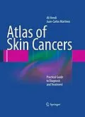 E-Book (pdf) Atlas of Skin Cancers von Ali Hendi, Juan Carlos Martinez