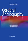 E-Book (pdf) Cerebral Angiography von Gianni Boris Bradac