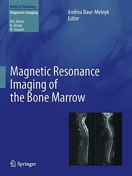 E-Book (pdf) Magnetic Resonance Imaging of the Bone Marrow von Andrea Baur-Melnyk