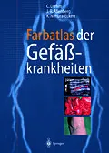 E-Book (pdf) Farbatlas der Gefäßkrankheiten von Curt Diehm, J.-R. Allenberg, Keiko Nimura-Eckert