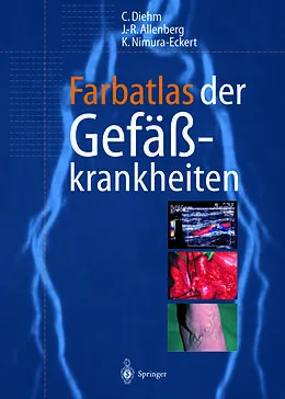 E-Book (pdf) Farbatlas der Gefäßkrankheiten von Curt Diehm, J.-R. Allenberg, Keiko Nimura-Eckert