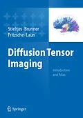 E-Book (pdf) Diffusion Tensor Imaging von Bram Stieltjes, Romuald M. Brunner, Klaus Fritzsche