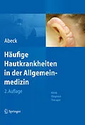 E-Book (pdf) Häufige Hautkrankheiten in der Allgemeinmedizin von Dietrich Abeck