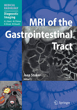 Kartonierter Einband MRI of the Gastrointestinal Tract von 