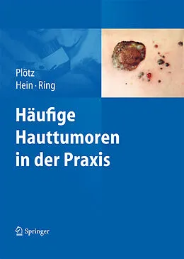 E-Book (pdf) Häufige Hauttumoren in der Praxis von Sabine G. Plötz, Rüdiger Hein, Johannes Ring