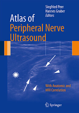 Livre Relié Atlas of Peripheral Nerve Ultrasound de 