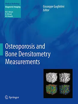 E-Book (pdf) Osteoporosis and Bone Densitometry Measurements von Giuseppe Guglielmi