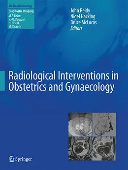 E-Book (pdf) Radiological Interventions in Obstetrics and Gynaecology von John Reidy, Nigel Hacking, Bruce McLucas