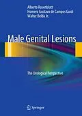 E-Book (pdf) Male Genital Lesions von Alberto Rosenblatt, Homero Gustavo De Campos Guidi, Walter Belda Jr.