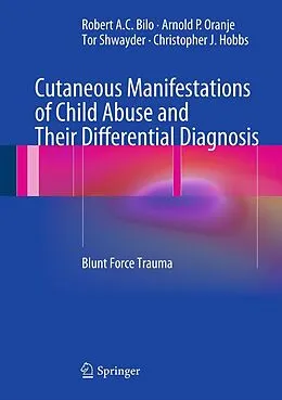 E-Book (pdf) Cutaneous Manifestations of Child Abuse and Their Differential Diagnosis von Robert A. C. Bilo, Arnold P. Oranje, Tor Shwayder