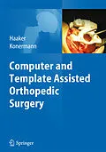 E-Book (pdf) Computer and Template Assisted Orthopedic Surgery von Rolf Haaker, Werner Konermann