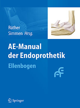 E-Book (pdf) AE-Manual der Endoprothetik von Wolfgang Rüther, Beat Simmen