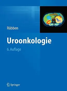E-Book (pdf) Uroonkologie von Herbert Rübben