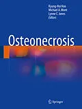 E-Book (pdf) Osteonecrosis von Kyung-Hoi Koo, Michael A. Mont, Lynne C. Jones