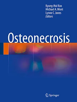 E-Book (pdf) Osteonecrosis von Kyung-Hoi Koo, Michael A. Mont, Lynne C. Jones