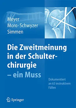 E-Book (pdf) Die Zweitmeinung in der Schulterchirurgie - ein Muss von Rainer Peter Meyer, Fabrizio Moro, Hans-Kaspar Schwyzer