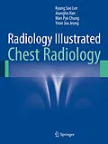 E-Book (pdf) Radiology Illustrated: Chest Radiology von Kyung Soo Lee, Joungho Han, Man Pyo Chung
