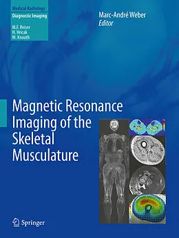 E-Book (pdf) Magnetic Resonance Imaging of the Skeletal Musculature von Marc-André Weber