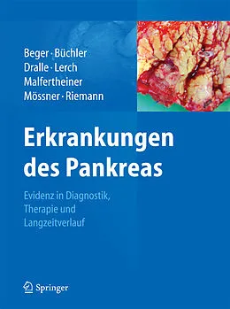 E-Book (pdf) Erkrankungen des Pankreas von Hans Günther Beger, Markus W. Büchler, Henning Dralle